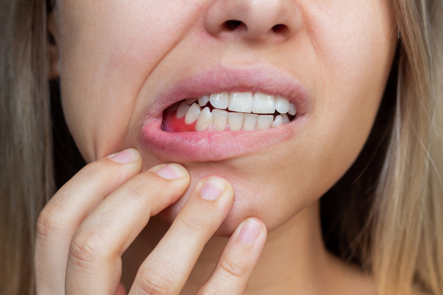 Understanding and Managing Gum Disease